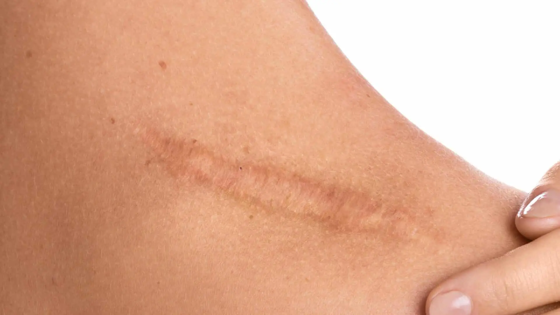 Huile de nigelle non filtrée